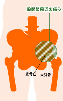股関節周辺の痛み